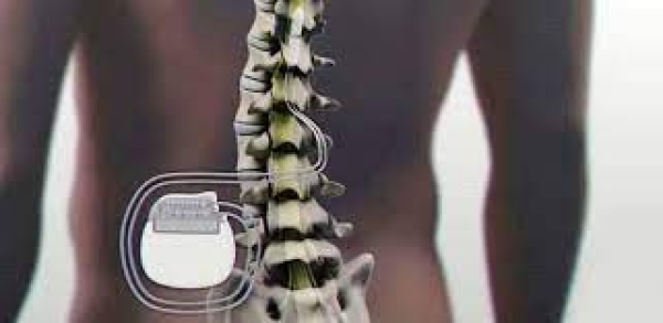 Dolore cronico nella polineuropatia diabetica (Pnd): al Perrino la prima stimolazione spinale in un ospedale pugliese